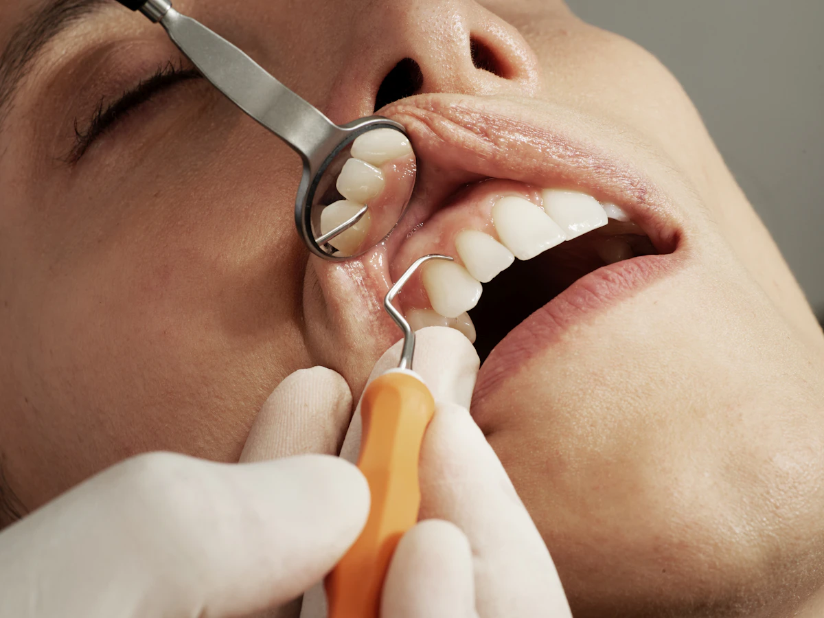 Limpieza dental con espejo e instrumental
